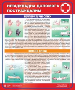 Хімічні опіки. Температурні опіки. Домедична допомога постраждалим.  0,5х0,6